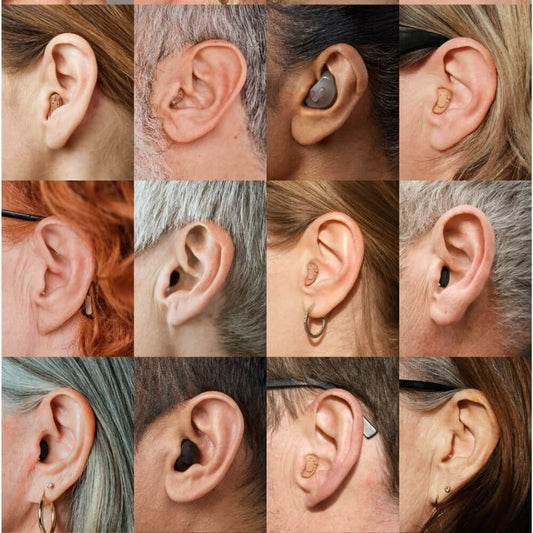 The Role of Antioxidants in Preventing Hearing Loss